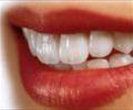 buy-sell personal health-beauty  دندانهای سالم زیبا ، سفید و روشن 