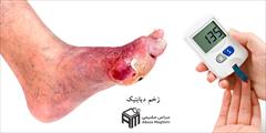 services health-beauty-services health-beauty-services درمان زخم دیابتی | کلینیک بهبودان