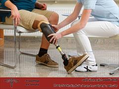 services health-beauty-services health-beauty-services (Transtibial Prosthesis (Below Knee Prosthesis پرو