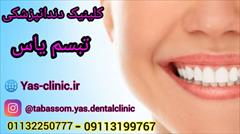 services health-beauty-services health-beauty-services کلینیک دندانپزشکی تبسم یاس بابل