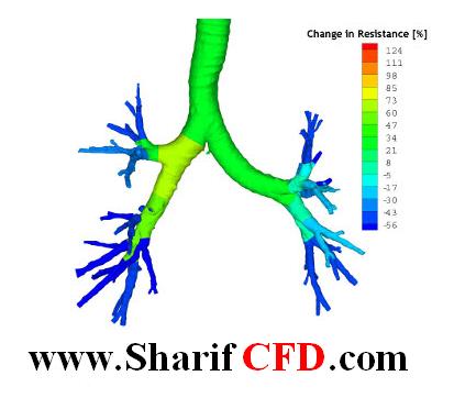 انجام پروژه مهندسي پزشکی در ديناميك سيالات محاسباتي به صورت تخصصی، مسقيم و بدون واسطه توسط تيم کارشناسان با تجربه فارغ التحصيل از دانشگاه صنعتي شريف ب services educational educational