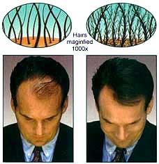 تقویت موی سر<br/>تقویت موی سر مرد<br/>تقویت و پرپشت کردن موی سر<br/>پودر پرپشت کننده مو<br/>پودر پرپشت کننده مو در10 ثانیه<br/><br/>پودر پرپشت کننده مو در 30 ثانیه(Topp buy-sell personal health-beauty
